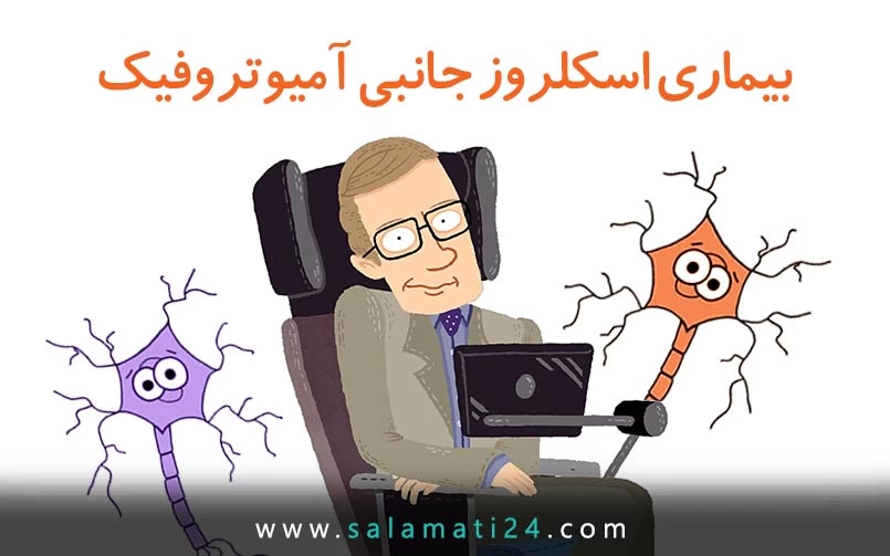 اسکلروز جانبی آمیوتروفیک