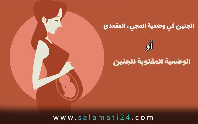 الجنين في وضعية المجيء المقعدي أو الوضعية المقلوبة للجنین