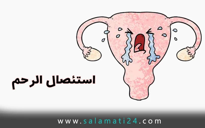 استئصال الرحم