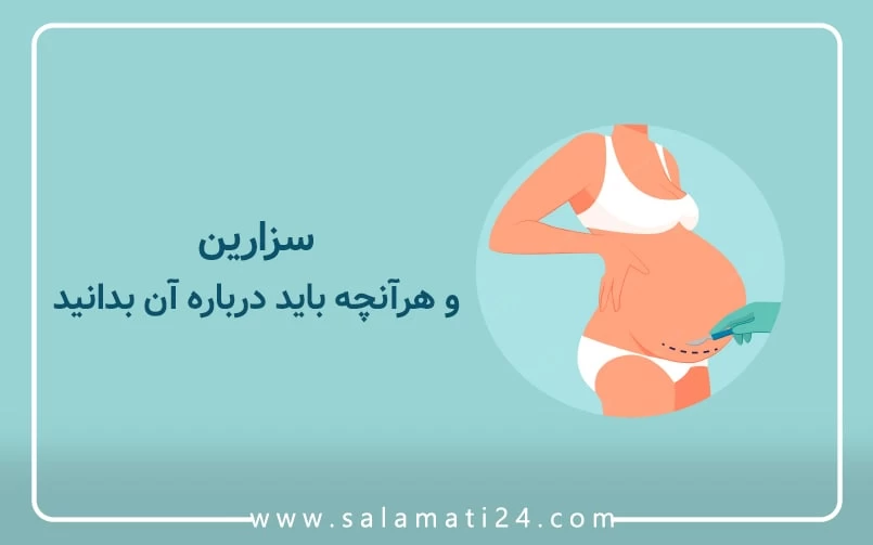 سزارین و هر آنچه باید درباره آن بدانید