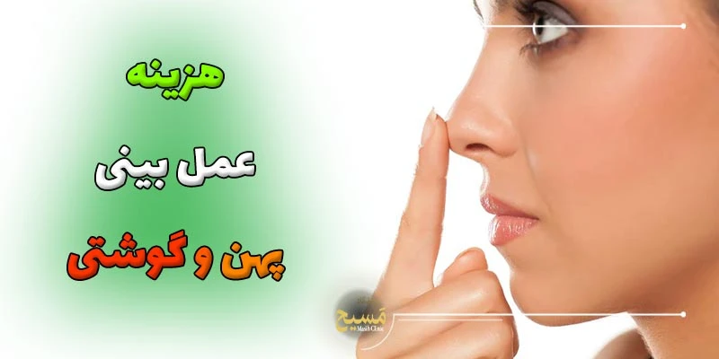 blog-image