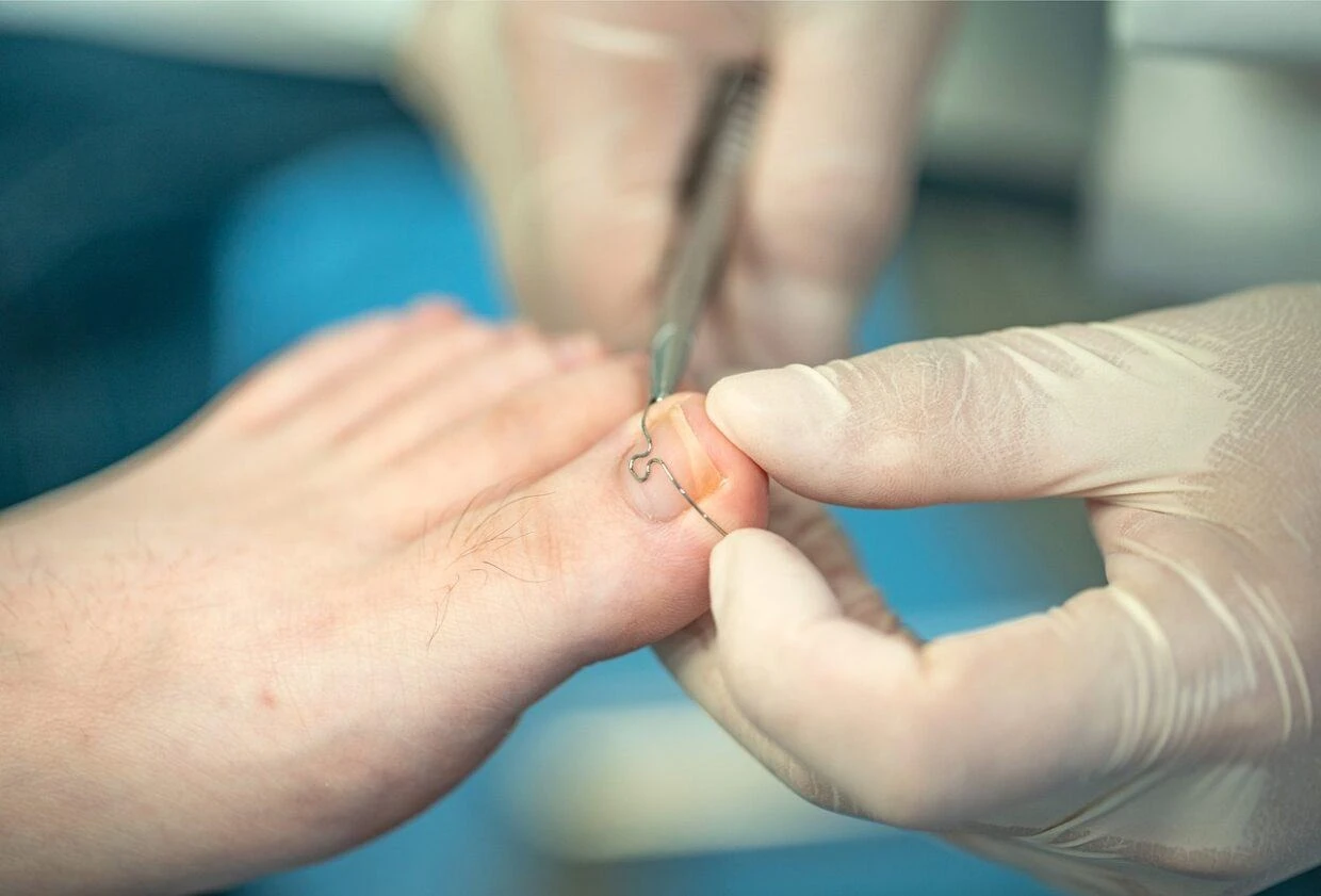 blog-image
