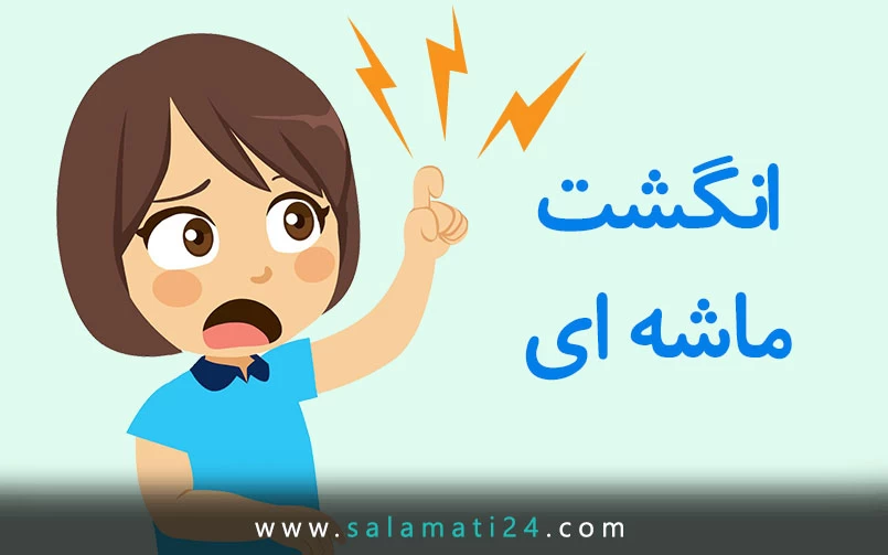 انگشت ماشه ای یا تریگر فینگ و علائم آن