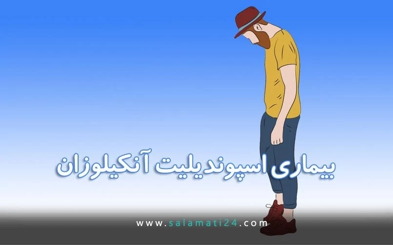 اسپوندیلیت آنکیلوزان