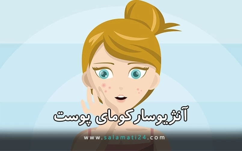 آنژیوسارکوم