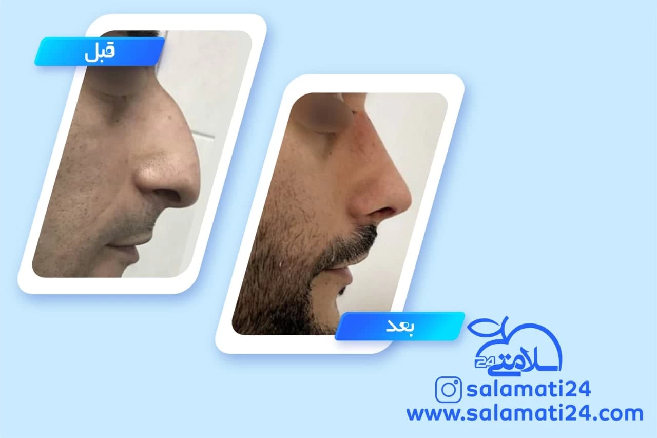 نمونه کار دکتر  سامان خرمی نژاد