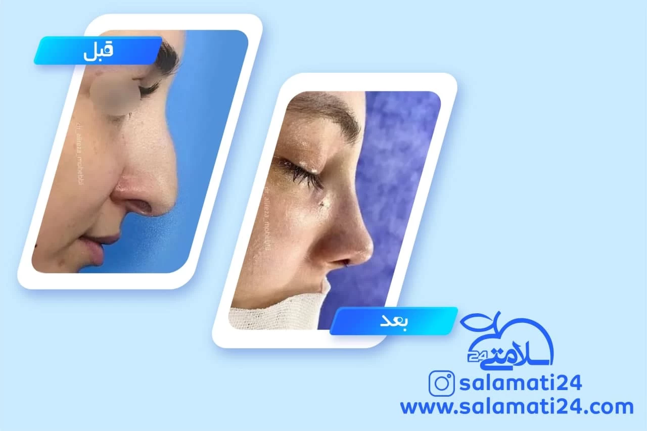 نمونه کار دکتر علیرضا محبی