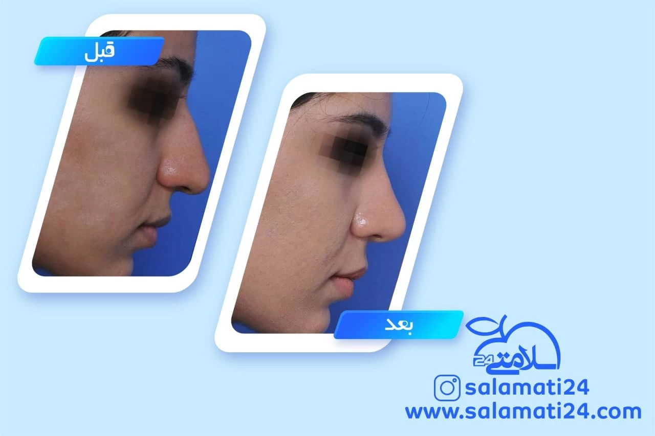 نمونه کار دکتر فرزین سرکارات