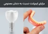 مزایای ایمپلنت دندان نسبت به دندان مصنوعی