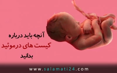 آنچه باید درباره کیست های درموئید بدانید