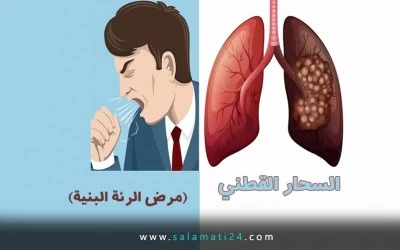 مرض الرئة البنية أو السحار القطني