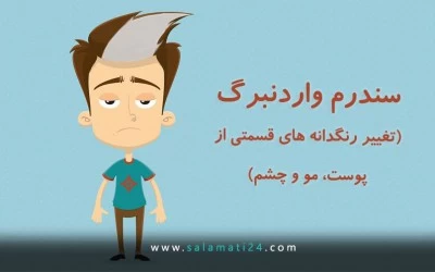 سندرم واردنبرگ