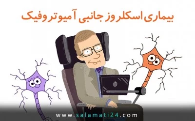 اسکلروز جانبی آمیوتروفیک