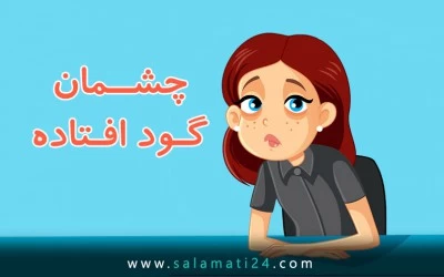 گودافتادگی زیر چشم