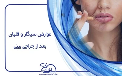 عوارض سیگار و قلیان قبل و بعد از جراحی بینی