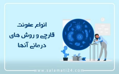 انواع عفونت‌ قارچی و روش های درمانی آنها