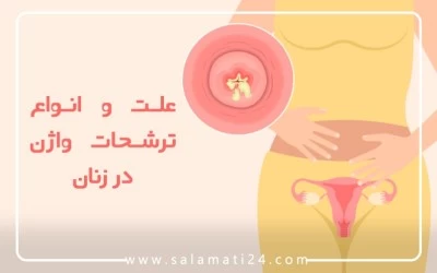 علت و انواع ترشحات واژن در زنان