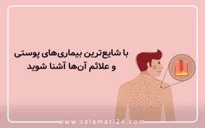 با شایع ترین بیماری های پوستی و علائم آنها آشنا شوید