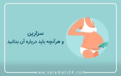 سزارین و هر آنچه باید درباره آن بدانید