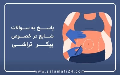 پاسخ به سوالات شایع در خصوص پیکر تراشی