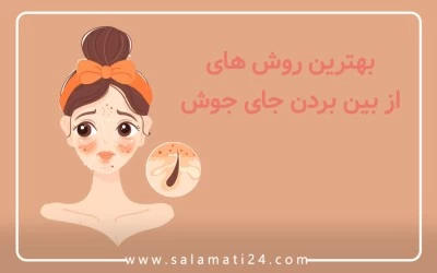 بهترین روش های  از بین بردن جای جوش