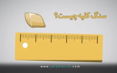 سنگ کلیه: علائم، علت ها و درمان