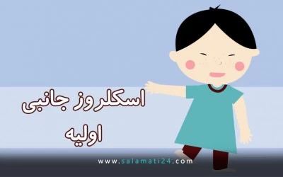 اسکلروز جانبی اولیه