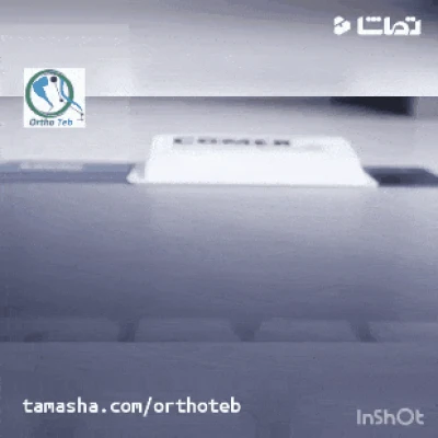 درمان خارپاشنه در مشهد