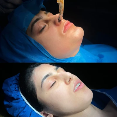 تغییرات جراحی