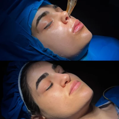 تغییرات جراحی