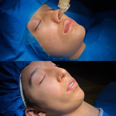 تغییرات جراحی