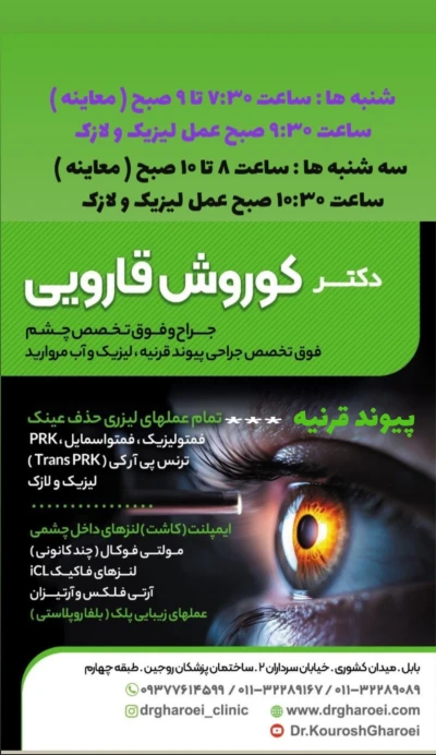 تمام عملهای چشم