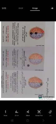 مطب