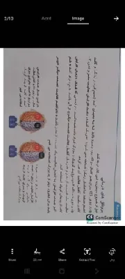 مطب