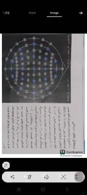 مطب