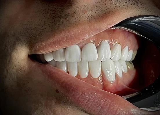 الدكتور سعید پورصادقی صور العيادة و موقع العمل4