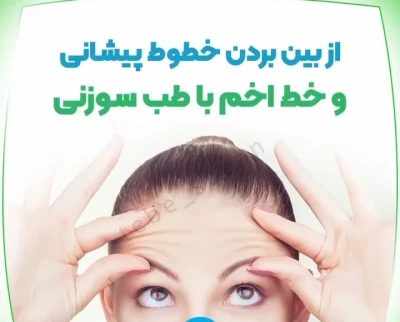 زیبایی با طب سوزنی