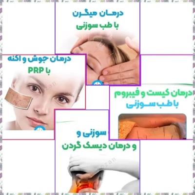 طب سوزنی آرتریت