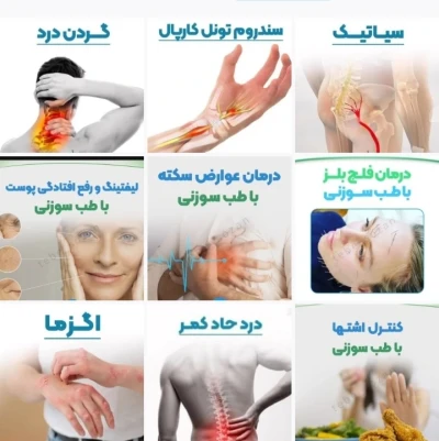 طب سوزنی معجزه طب چینی