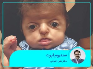 متلازمة أبيرت