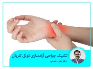 تکنیک جراحی آزادسازی تونل کارپال