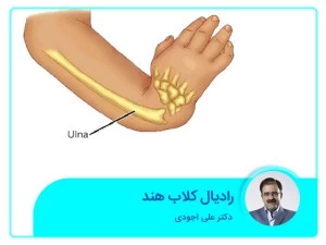 رادیال کلاب هند 