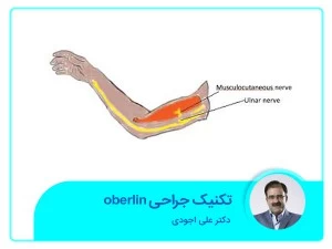 تکنیک جراحی oberlin