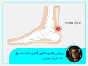 أمراض وتر العرقوب. الجزء الأول