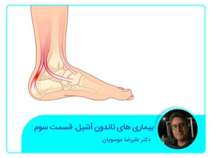 أمراض وتر العرقوب. الجزء الثالث