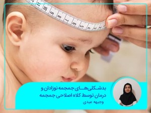 تشوهات جمجمة الأطفال الرضع والعلاج بواسطة قبعة تصحيح الجمجمة