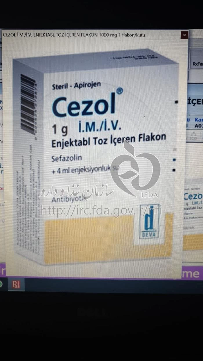 سزول