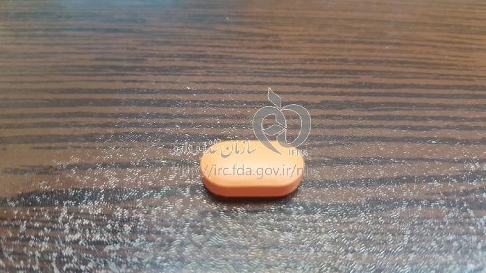 استاپارکین